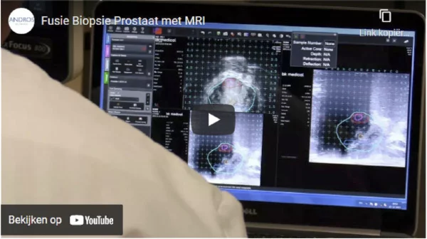 Bekijk de video Fusie Biopsie Prostaat met MRI op YouTube