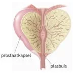 Leegpellen Prostaatkwabben Prostaatkapsel Andros Clinics