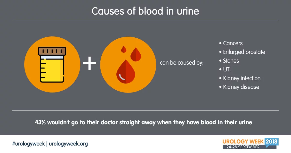 Oorzaken van Bloed in plas UrologyWeek 2018
