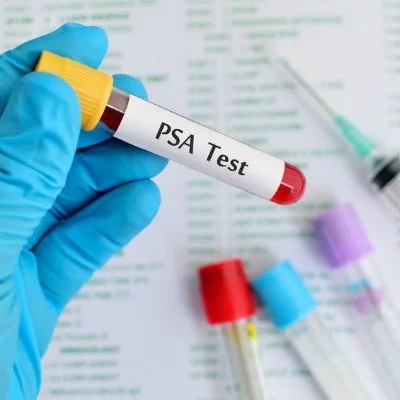 chronische prostatitis en psa waarde