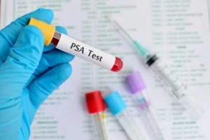 PSA Waarde Test is een bloedonderzoek in een laboratorium naar deze eiwit waarde van de prostaat