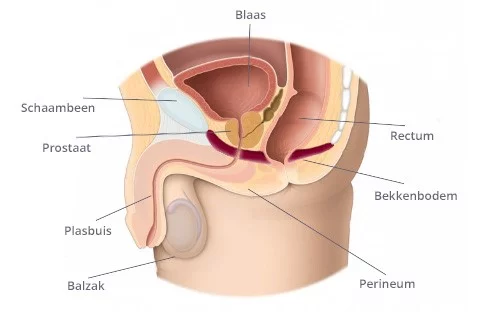 Bekkenbodem mannen hebben hem ook. Kan rol spelen bij prostaatklachten, plasklachten, vergrote prostaat en ontlasting.