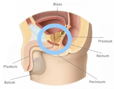 Waar zit de prostaat? In de onderbuik, diep in bekken. Onder de blaas met de plasbuis er dwars doorheen.