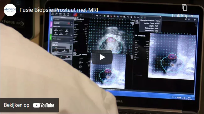 fusie biopsie prostaat met mri